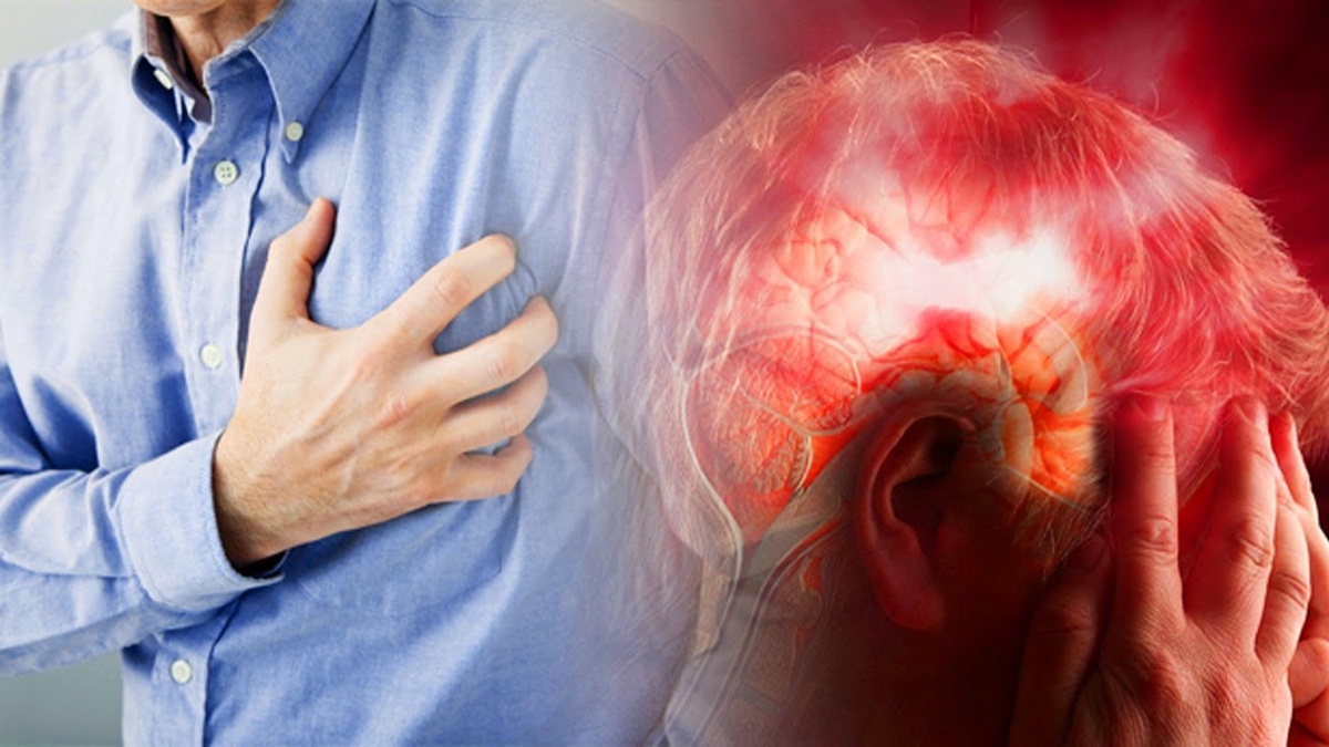 Когда головокружение может быть сигналом сосудистой катастрофы