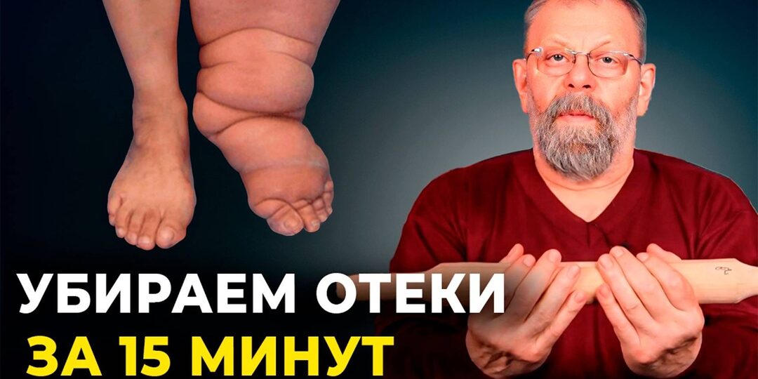 Когда Отёки Ног Говорят о Проблеме не с почками, а с сердцем