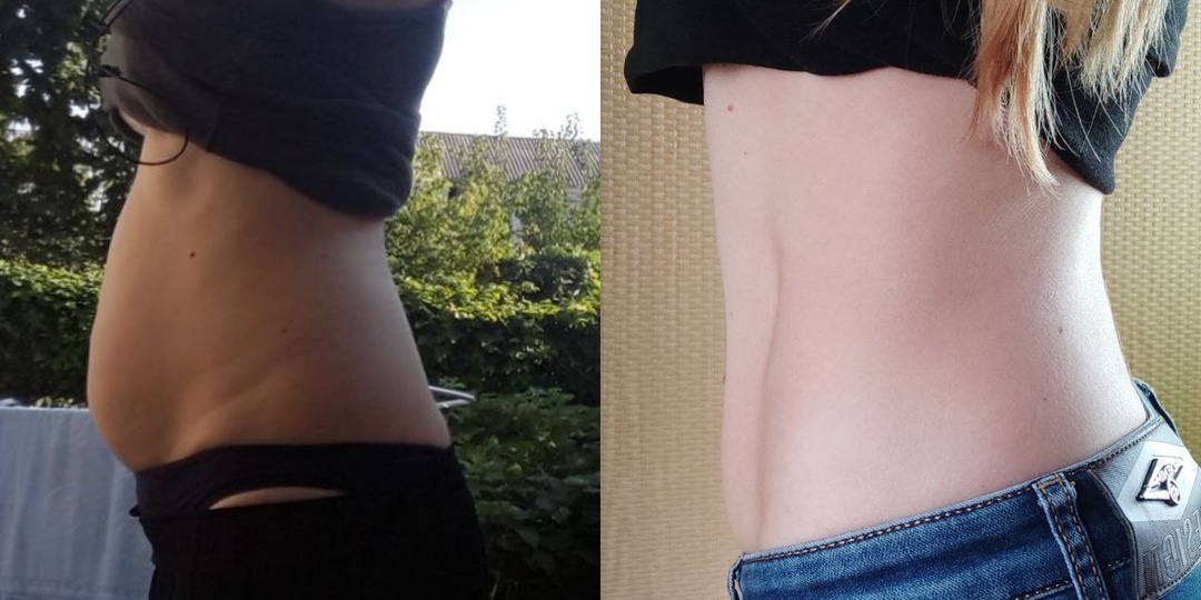 С 24 ноября стартует ПОСЛЕДНИЙ поток программы «Худей легко