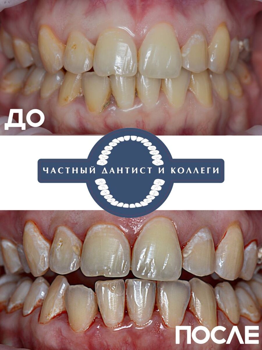 Создано в Частный Дантист и Коллеги