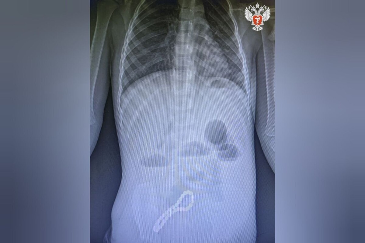     / Источник: Министерство здравоохранения Рязанской области