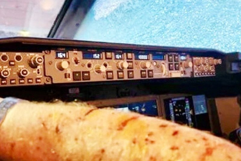 Порезы летчика на руке.  фото: яндекс