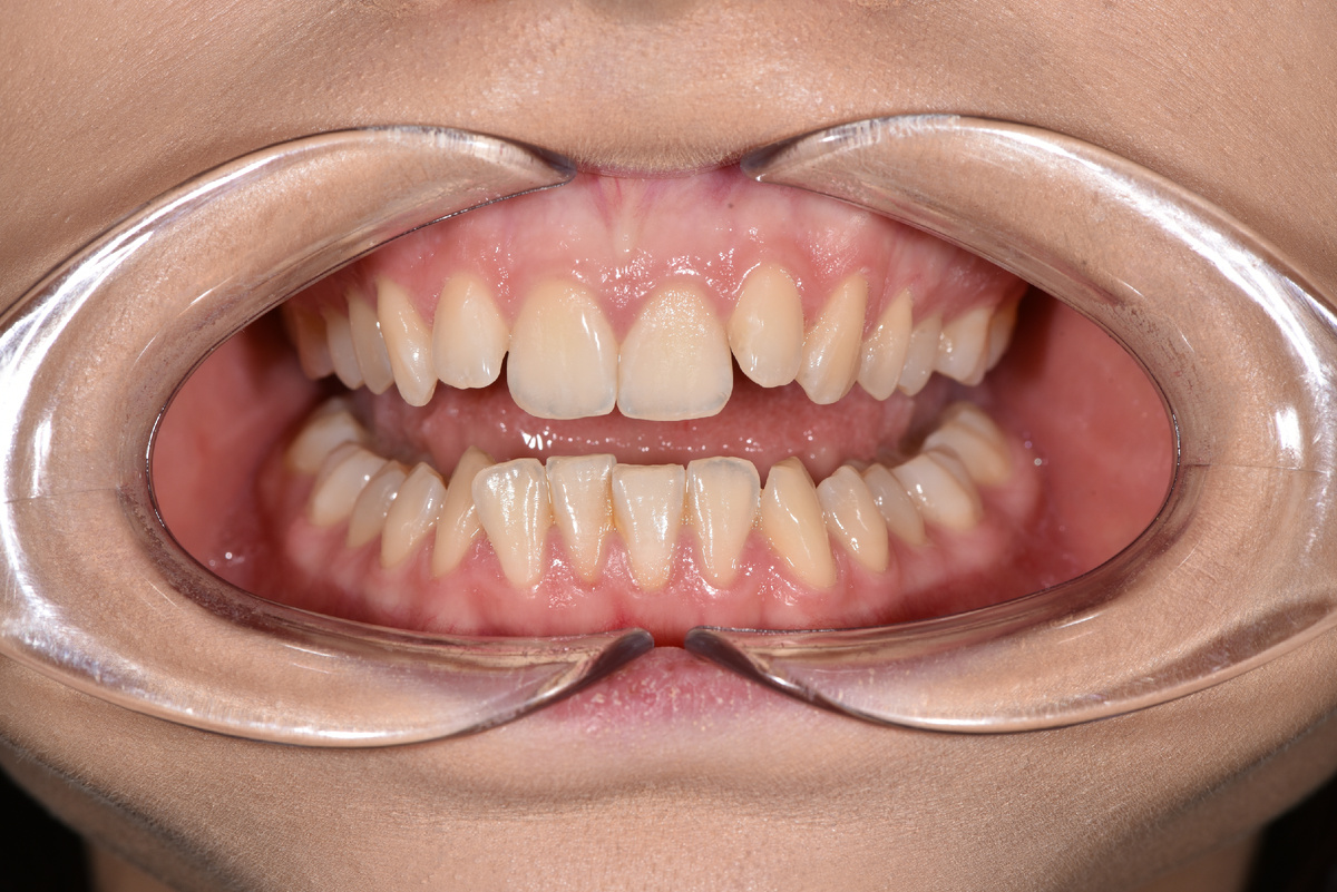 фото с первой консультации