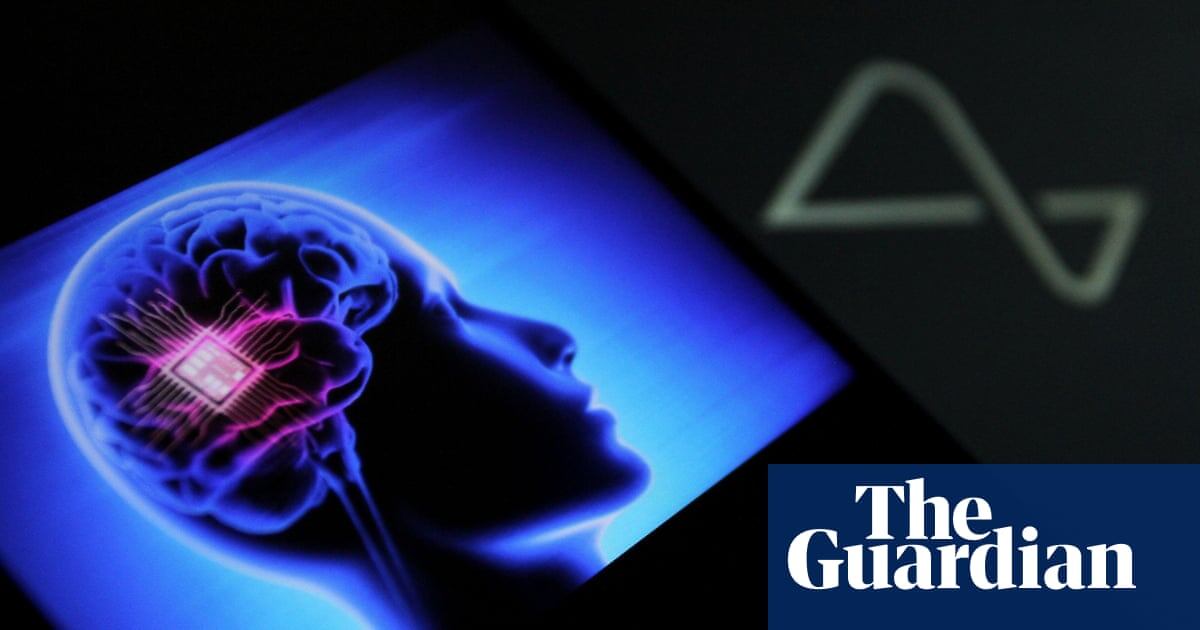 Добро пожаловать в будущее, где ты можешь управлять смартфоном… мозгом. Без рук. Без голоса. Просто мыслью 🤯✨
🧠 Как это вообще работает?
Специальные нейрогаджеты считывают твои мозговые импульсы (да-да, у тебя там целая электрическая вечеринка 🔌🧠).
Дальше ИИ переводит их в команды — и смартфон делает то, о чём ты подумал.
Ты такой:
👉 «Музыку погромче»
Телефон: “Сделано, босс.” 🎶
👉 «Дальше листай»
Телефон: “Как скажешь.”
🎮 Где мы это будем использовать?
🔥 Игры — двигай персонажем силой мысли. Без джойстиков. Без пальцев. Только ты и твои нейроны.
🔥 Соцсети — листай TikTok взглядом и мыслями. Только не думай о том, что пора спать 😅
🔥 Умный дом — представь, что ты такой думаешь: «Свет выключить!» — и всё, темнота.
🔥 И, конечно, главное — ЛЕНЬ
Когда не хочешь тянуться до экрана — будущее спасёт тебя 😌
😏 Это реально?
Удивительно, но да!
Уже есть рабочие прототипы, которые позволяют открывать приложения, печатать текст и даже играть.
А через пару лет это станет такой же обычной функцией смартфона, как Bluetooth или режим «Не беспокоить».