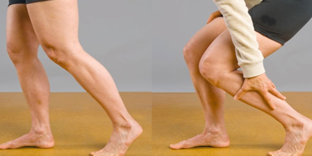 Почему вы до сих пор прихрамываете, даже когда кость после перелома уже срослась?