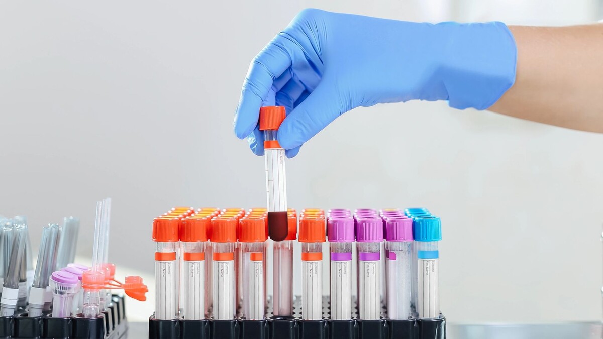    Фото: Kozak_photo /Shutterstock/Fotodom