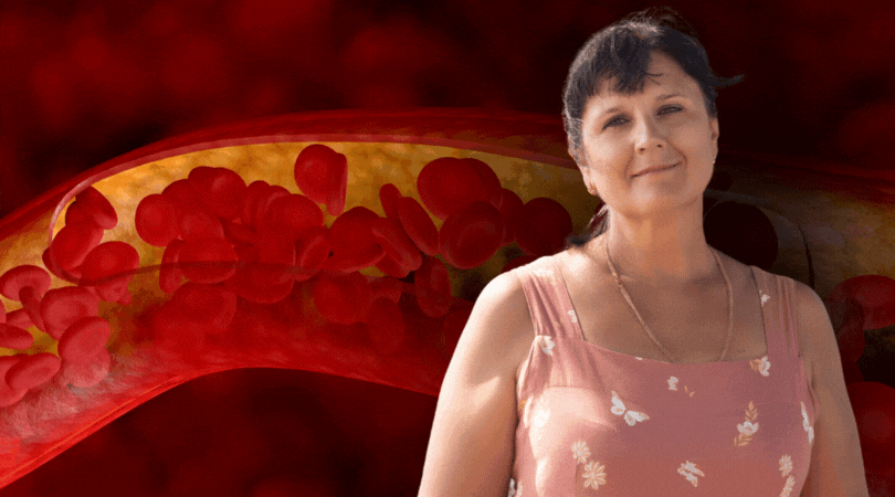 После 50 кровь густеет. Какой анализ предупредит о тромбах | Психосоматика