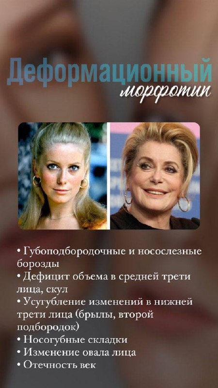 Деформационный морфотип