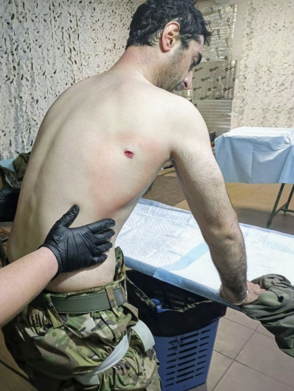    В ДНР из госпиталя пытаются отправить на суд раненого бойца Дирана Чепняна