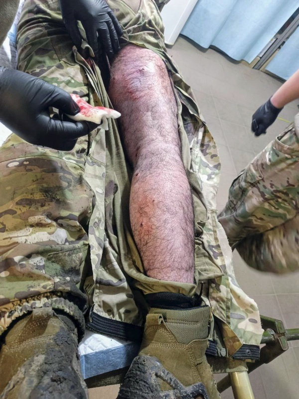    В ДНР из госпиталя пытаются отправить на суд раненого бойца Дирана Чепняна