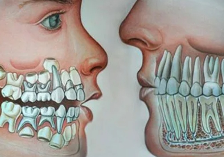 Что такое "сонная болезнь",и кто за один глоток получает полмиллиона килокалорий, а так же много,много других интересных фактов вокруг нас.