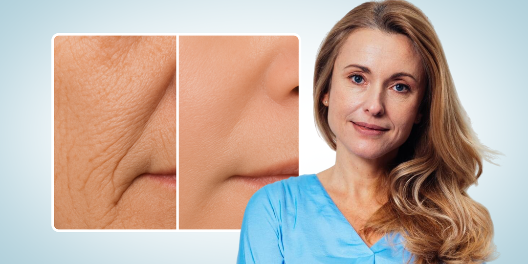 Неопрятное лицо: ТОП-3 ошибки, которые делают кожу тусклой, дряблой и возрастной