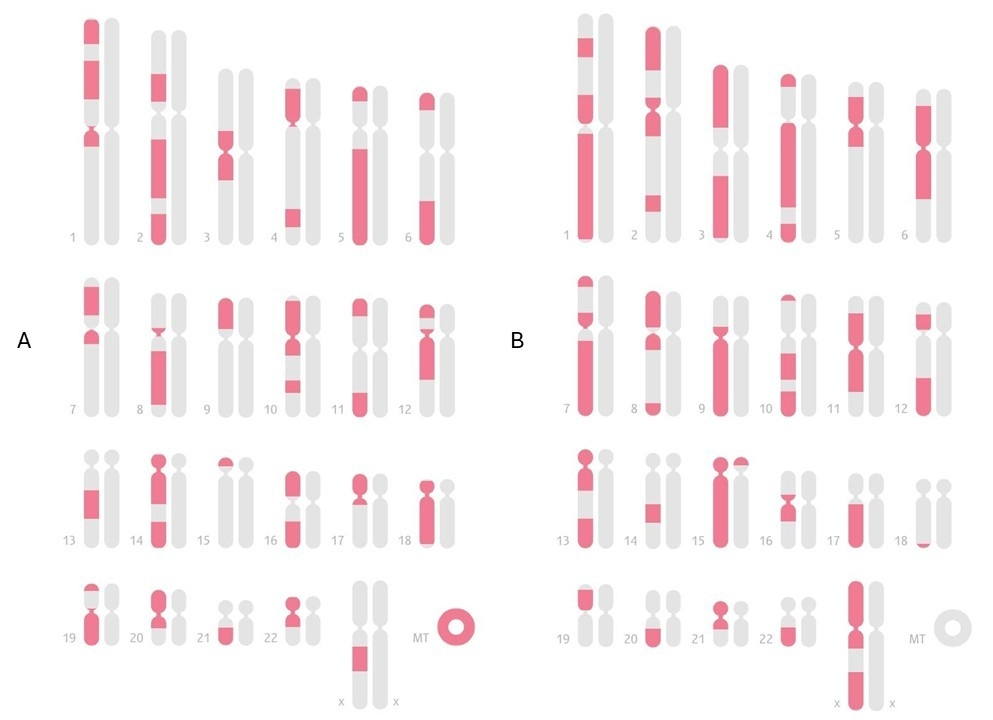 Рис. 1. Карта общих IBD-сегментов внучки с бабушкой (A) и дедушкой (B) по материнской линии. Скриншоты из личного кабинета Genotek; предоставлены пользователем и использованы с его согласия.
