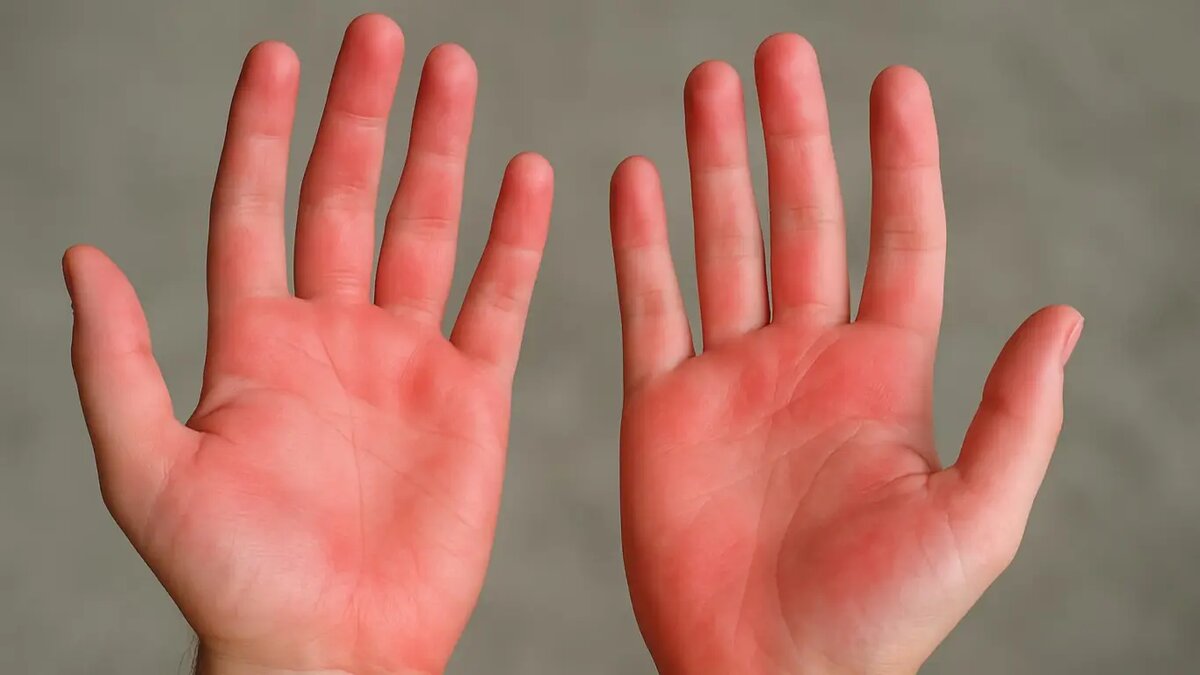 Что расскажут о здоровье ладони: симптомы и возможные причины