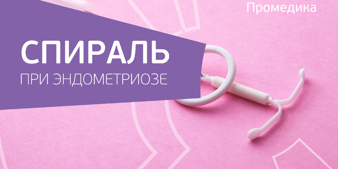 Спираль (ВМС) при эндометриозе. Жизнь без боли и ограничений