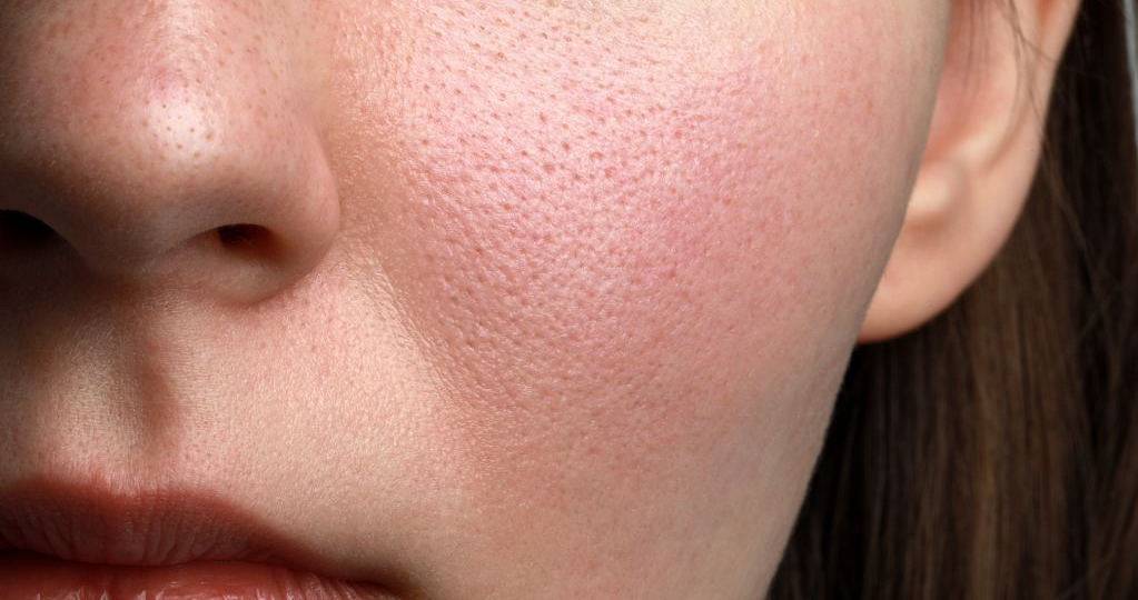 Ваша кожа расскажет все: какие болезни можно прочитать на лице