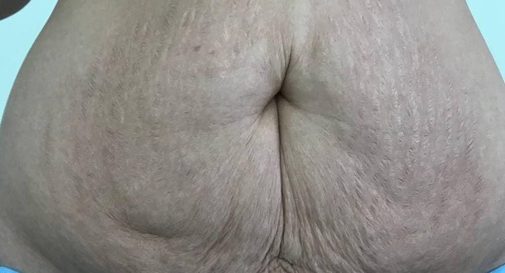 Почему появляется «фартук»?