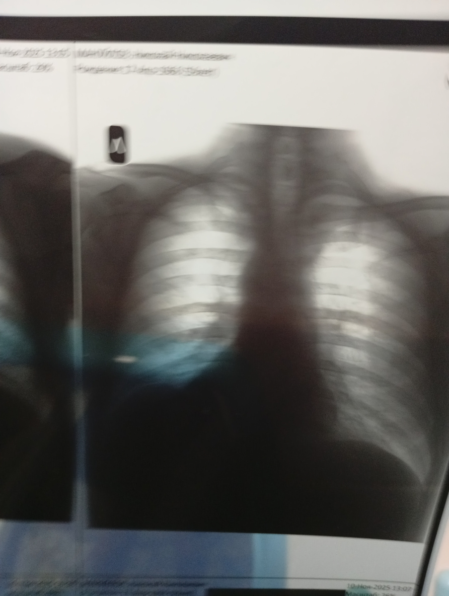 Мой снимок. 