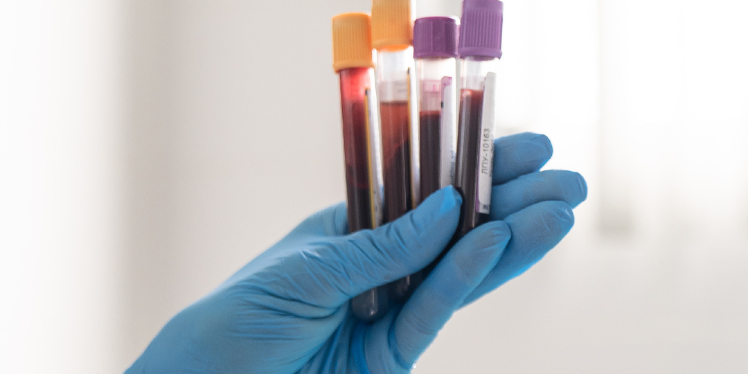 Ранний рак: особенности диагностики, лечения и наблюдения