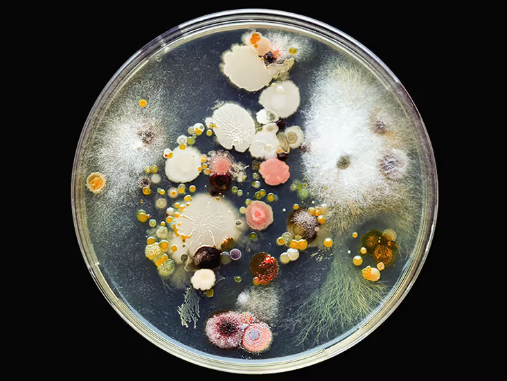 Почва - местообитание разнообразных микроорганизмов. Среди них есть и друзья, и враги.