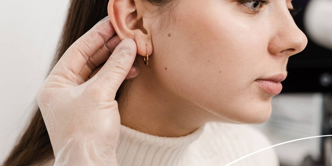 Осторожно: прокол ушей! Как сделать менее заметным шрам после неудачной процедуры