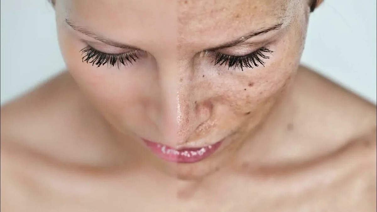 ИМЕЮТСЯ ПРОТИВОПОКАЗАНИЯ, НЕОБХОДИМА КОНСУЛЬТАЦИЯ СПЕЦИАЛИСТА