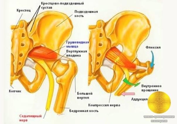 «Зажатая» грушевидная мышца — невидимая причина боли в ягодице, которая отдает в ногу. И простое упражнение для снятия спазма за 2 минуты.