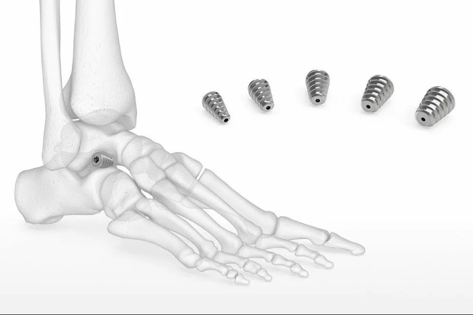 Примерно вот так