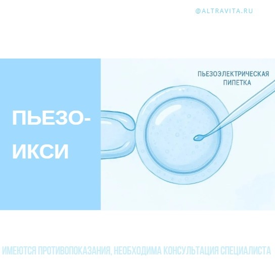 Пьезо - ИКСИ при ЭКО