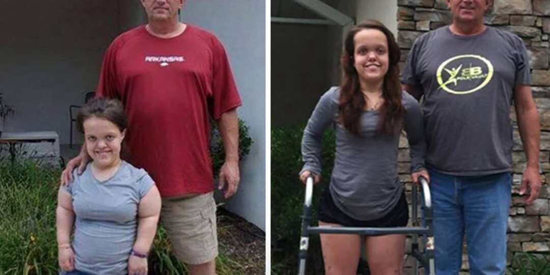 От 117 сантиметров к новой жизни: её путь вдохновляет тысячи