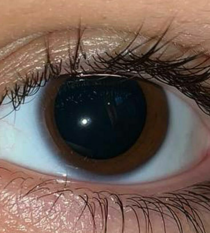 из открытого источника