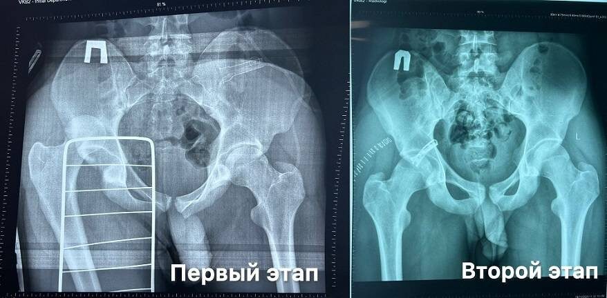    Источник фото: t.me/vkb2ru