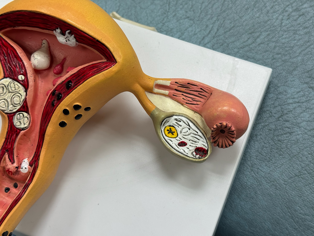 Фото с сайта "Екатеринбургский Медицинский Центр"