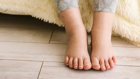 Почему у меня опухают ступни и лодыжки?