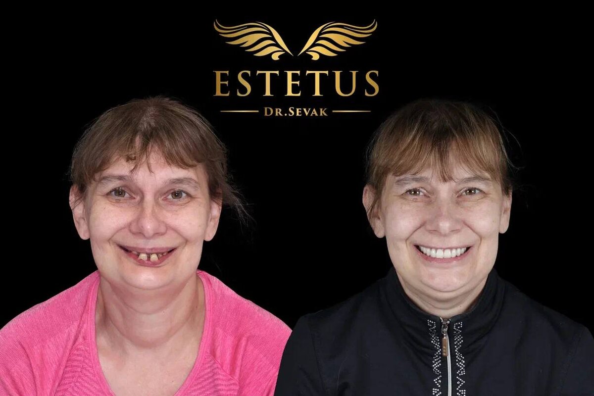 Елена Леонидовна, г. Москва, клиника доктора Севака Estetus