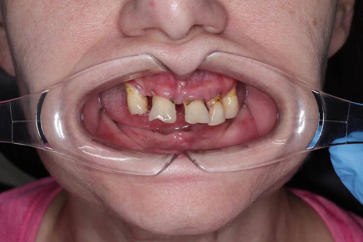 Елена Леонидовна, г. Москва, клиника доктора Севака Estetus