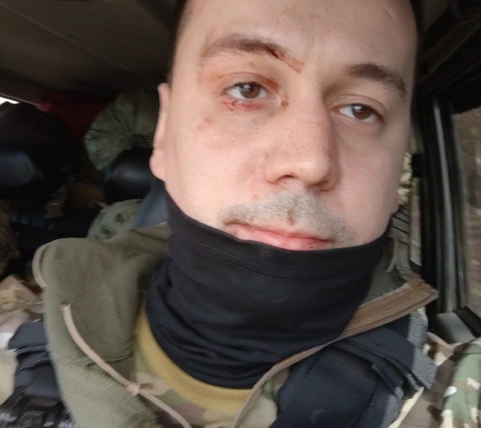 Аид - Бекхан Юнусов после атаки Хаймарсом / телеграм-канал "Дневник Мракоборцев"