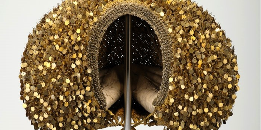 Они называли это шляпками: 16 исторических примеров жертвы красоте