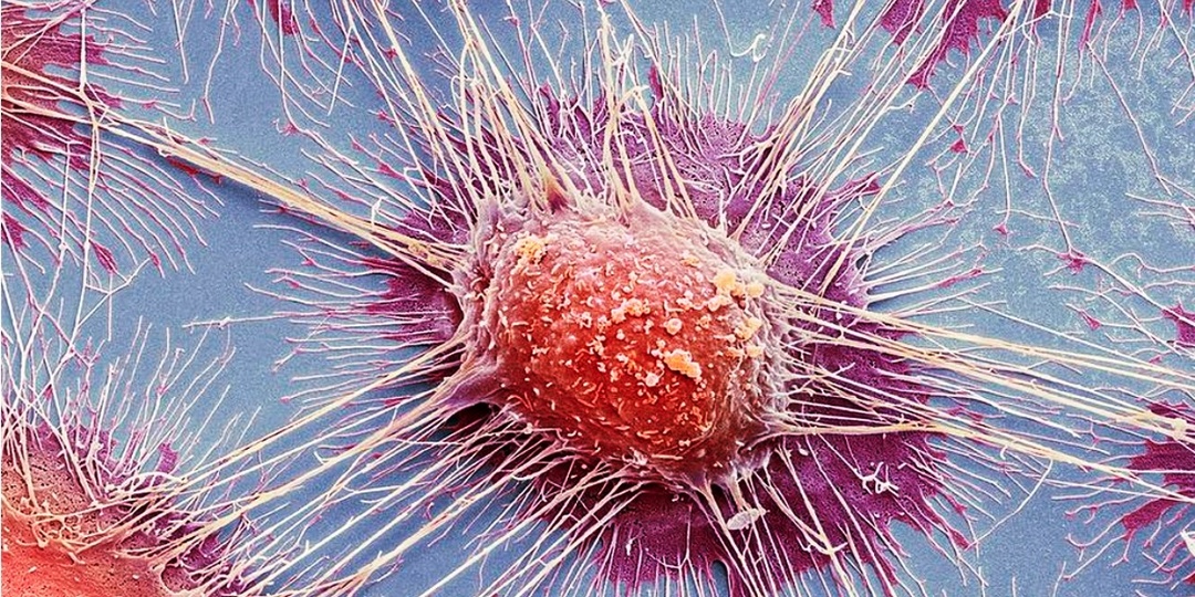 Ученые нашли способ заставить опухоль уничтожать себя изнутри. Вот как это работает
