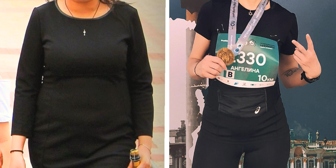 Похудение при гипотиреозе: почему вес растет, даже если почти не ешь