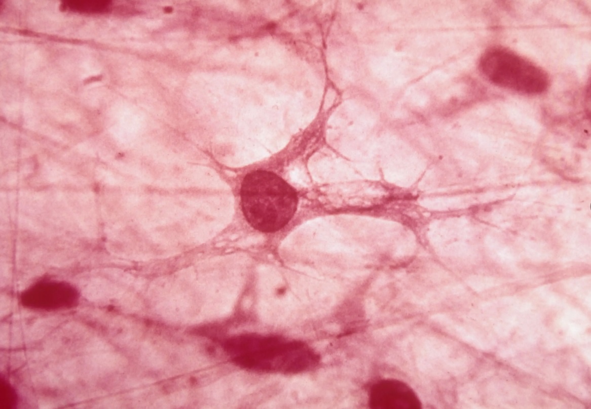 Фибробласты