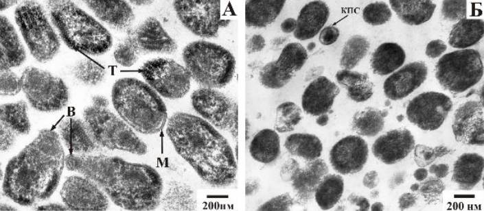 Трансмиссивные микрографии ВФ (А) и НФ (Б) клеток M. gallisepticum S6. Т – тубулиноподобные
структуры, В – терминальная структура "bleb", М – клеточная мембрана, КПС – капсулоподобная структура.                                                                                                                                                                                            Источник: АДАПТАЦИЯ МИКОПЛАЗМ (MYCOPLASMA GALLISEPTICUM S6) К НЕБЛАГОПРИЯТНЫМ УСЛОВИЯМ МУЗЫКАНТОВ А. А.