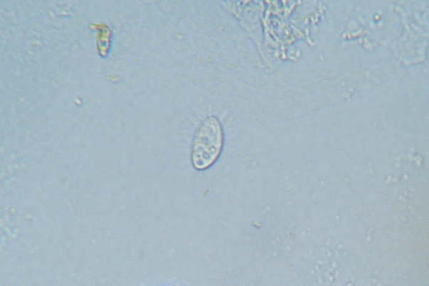 Вот гифка, изображающая движение с помощью ресничек