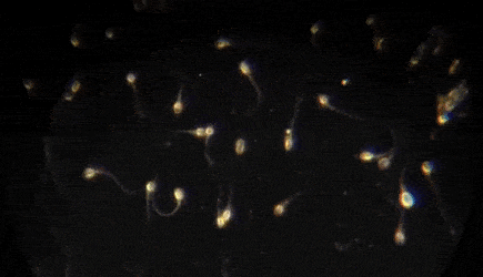 Движение сперматозоидов