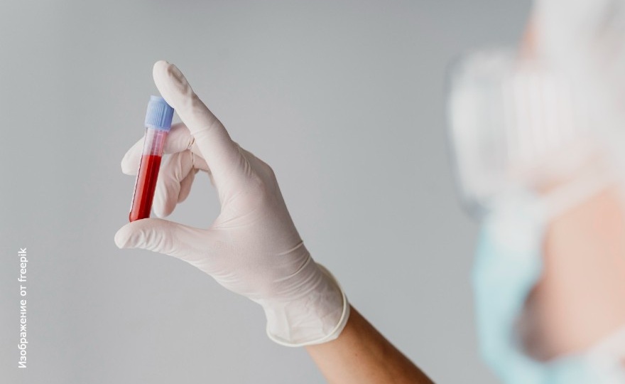 Глюкоза крови: какой уровень оптимален?