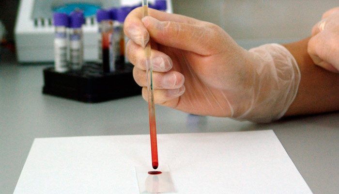 Недавно открытый вид грибка заставлил чесаться европейцев (и не только их). Фото: pxhere.com