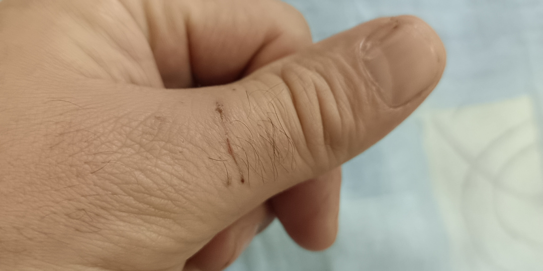 Собака бывает кусачей.Но дело совсем не в собаке☺