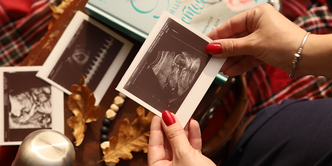 Мой путь к материнству: чего он нам стоил и стоил ли того?