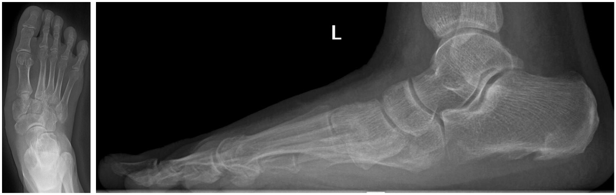 До операции