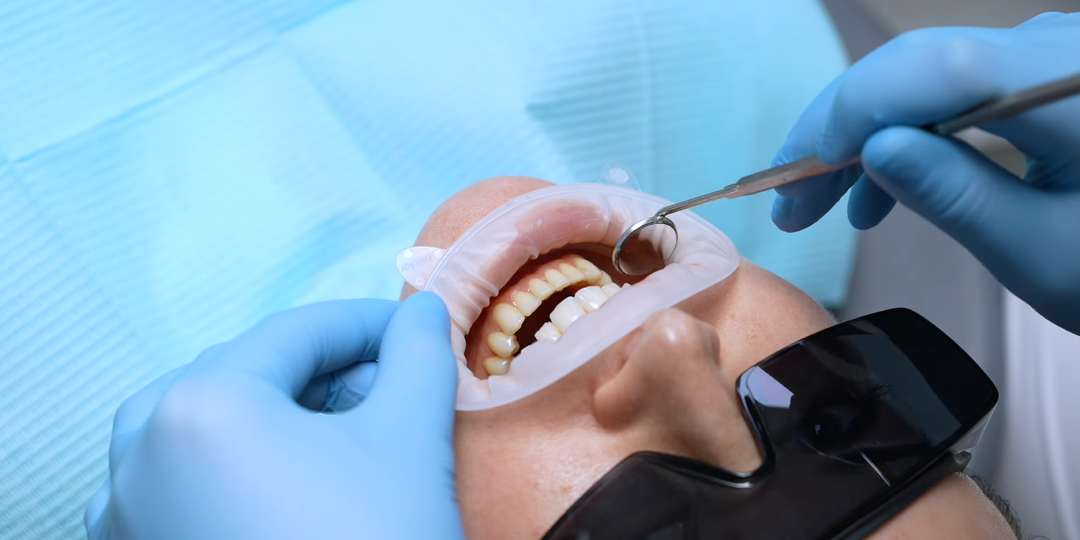 Почему раньше коронки «стояли по 25 лет», а сейчас — нет?